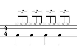 music