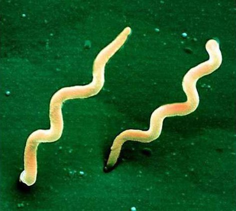 borrelia burgdorferi