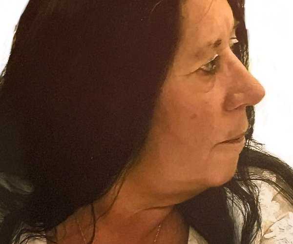 Bonnie D. (Burns) Hartley