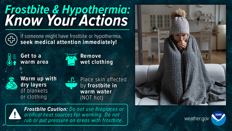 hypothermia frostbite